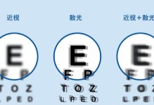 散光造成的视觉缺陷及治疗方法（深入了解散光矫正与视觉提升，护眼从今开始）